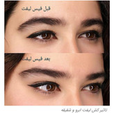کش لیفت ابرو وشقیقه